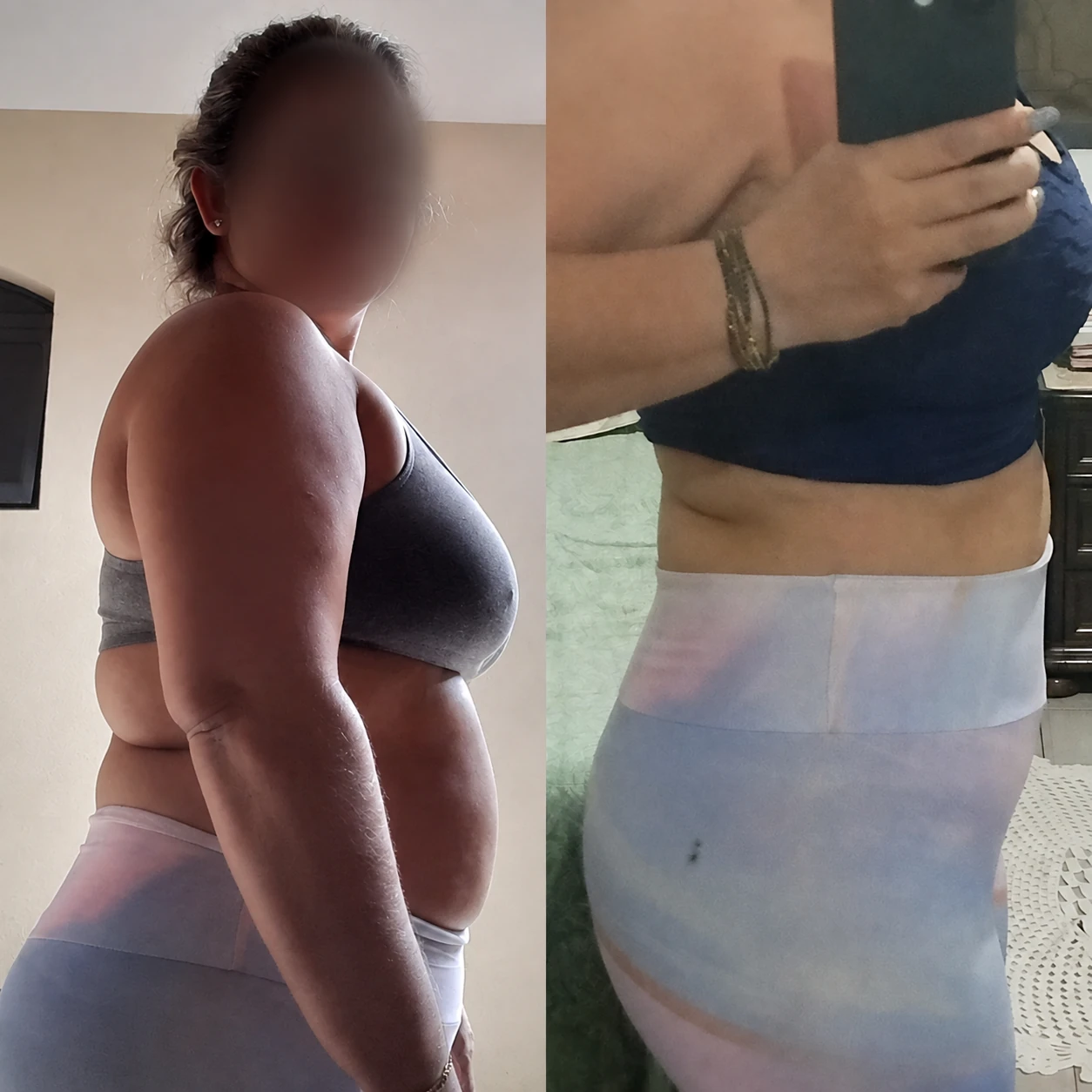 Antes e depois de aluna acompanhada por Matheus Henrique em trabalho de musculação e composição corporal.
